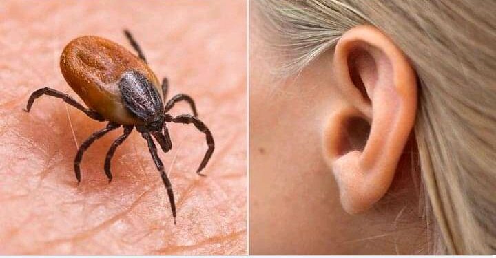 Disturbing: A Woman’s Mysterious Ear Pain Turns Out to Be a Tick.