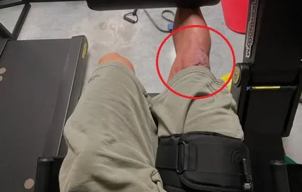 Wout Van Aert onthult omvang knieblessure in Instagram-bericht