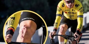 Wout Van Aert: “Dat heeft de pijn wat verzacht”