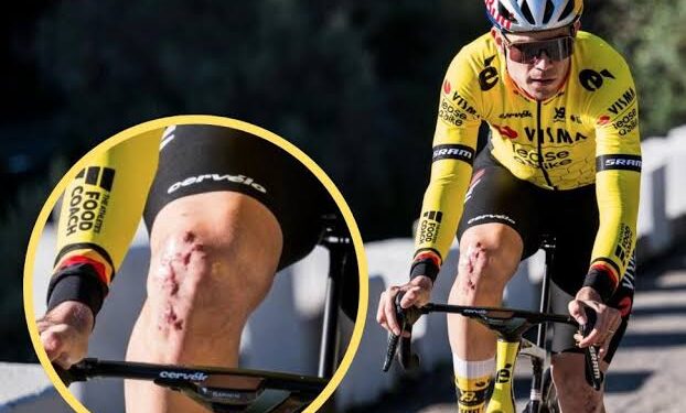 Wout Van Aert: “Dat heeft de pijn wat verzacht”