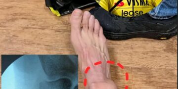 Het korte maar oprechte bericht van Van Aert raakte meteen een gevoelige snaar binnen de wielerwereld. “De moeilijkste periode die ik de voorbije tijd heb doorgemaakt.”