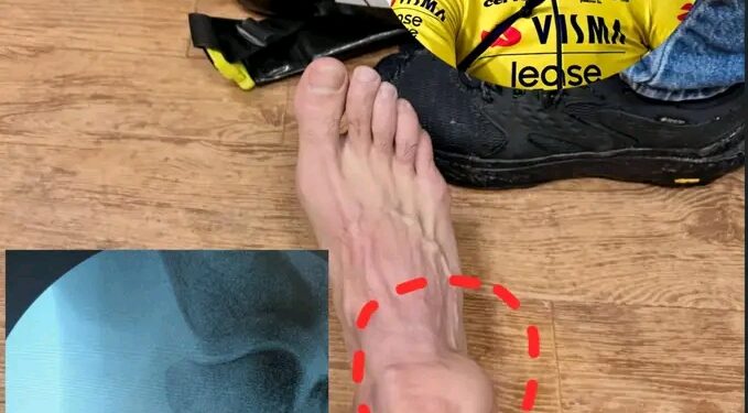 Het korte maar oprechte bericht van Van Aert raakte meteen een gevoelige snaar binnen de wielerwereld. “De moeilijkste periode die ik de voorbije tijd heb doorgemaakt.”